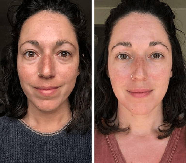 24K Gold Energy Beauty Bar – Electric Facial Massage Roller