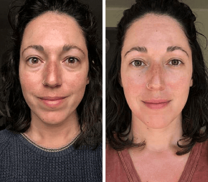 24K Gold Energy Beauty Bar – Electric Facial Massage Roller