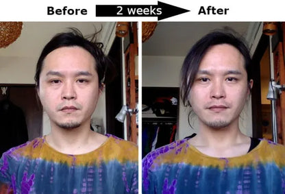 24K Gold Energy Beauty Bar – Electric Facial Massage Roller